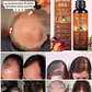 Clinical-grade anti-hair loss and hair growth serum