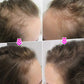 🔥BUY 2 GET 1 FREE💝Hair Thickening Hair Building Fiber Powder