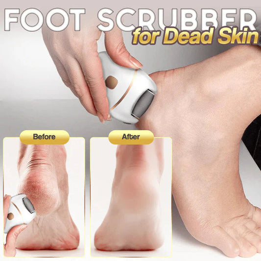 ⏳ Limited-time offer⏳ Rechargeable electric foot file for calluses Two speeds and removable sanding head USB charging Available in four colours
