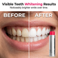 🥳2026 HOT SALE🥳💞50K+ SOLD!😁✨ 50% OFF! Stain‑Removing Whitening Mouthwash – Lifts coffee & tea stains, alcohol‑free. Instant gunk binding, long‑lasting minty fresh. Gentle enough for daily use. 🦷💙