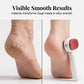 🦶✨50% OFF! 💨💅 Double-Sided Foot Scraper – Removes Calluses & Dead Skin Easily for Smooth, Baby-Soft Feet at Home. Over 41,728 Silky-Smooth Heels!✨