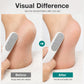 🦶🔥HOT SALE! Dual-Sided Foot File Callus Remover